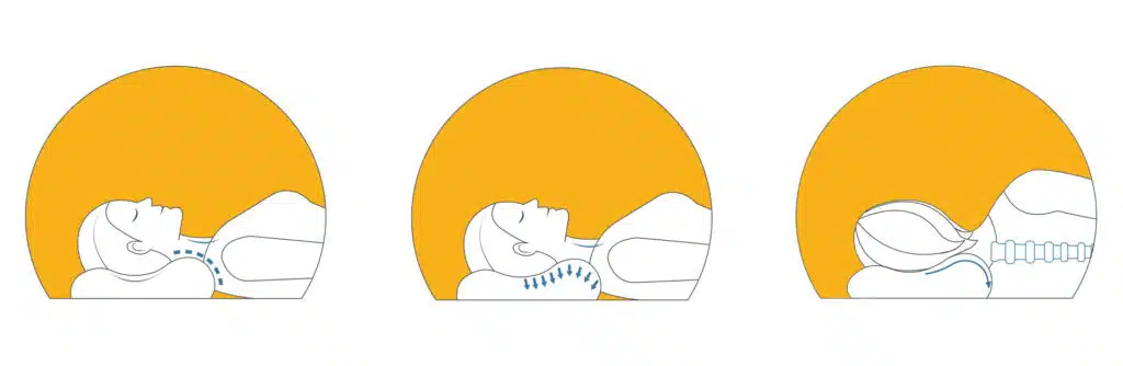 position de la nuqye avec une oreiller ergonomique